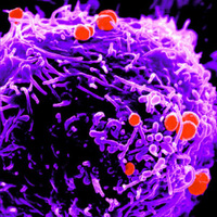 Гонококки на поверхности лимфоцита (фото с сайта neisseria.org)